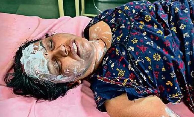 शिवपुरी-में-महिला-टेलर-ने-पार्षद-के-घर-पर-पेट्रोल-छिड़ककर-आग-लगाई,-पार्षद-और-टेलर-दोनों-झुलस-गए