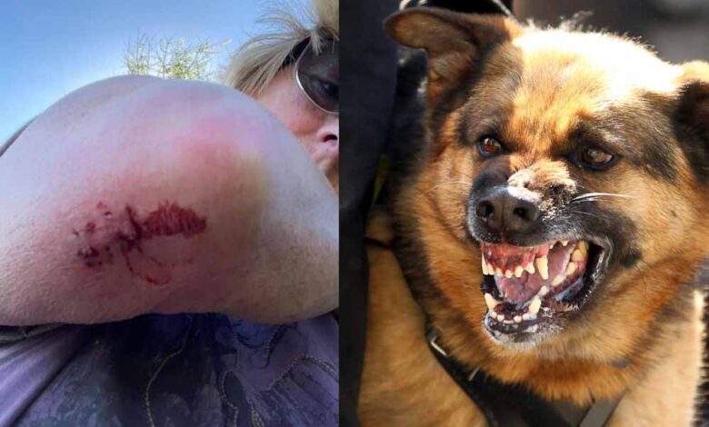 इंदौर-में-डॉग-बाइट-के-मामले-बढ़े,-7-महीने-में-28,142-लोग-बने-शिकार