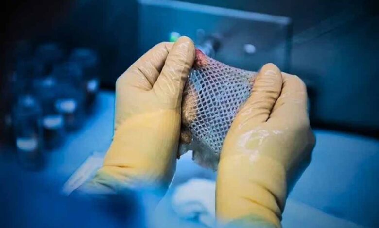 विन्ध्य क्षेत्र में पहली बार हुआ स्किन डोनेशन