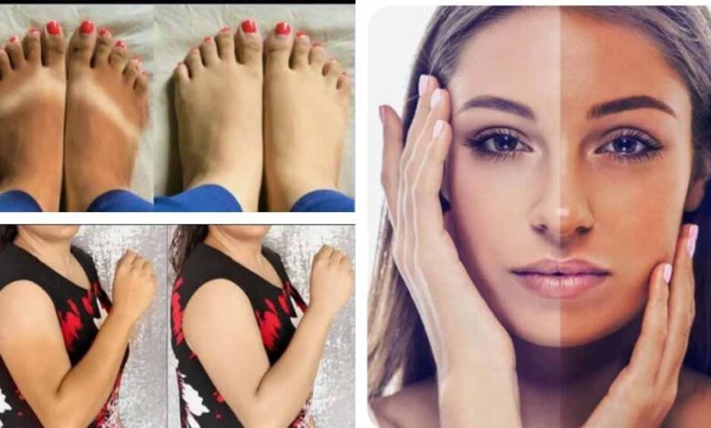 धूप-से-काली-पड़-गई-स्किन?-रात-में-अपनाएं-ये-नुस्खे-और-पाएं-ग्लोइंग-चेहरा