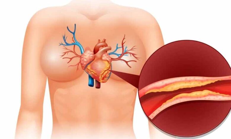 कोलेस्ट्रॉल-क्या-है-और-शरीर-में-इसकी-क्या-भूमिका-होती-है?