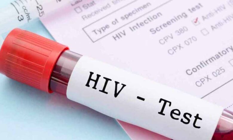 hiv-रिपोर्ट-गोपनीयता-पर-नई-गाइडलाइन:-अब-सिर्फ-डॉक्टर-ही-देख-सकेंगे-मरीज-की-जानकारी