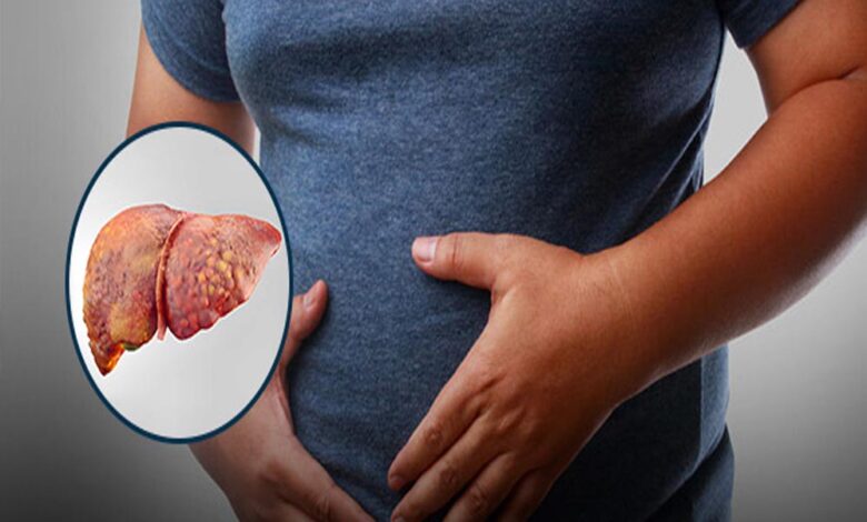 आइसक्रीम और च्युइंग गम खा रहे हैं? नई स्टडी में पता चला, ये लिवर के लिए हानिकारक