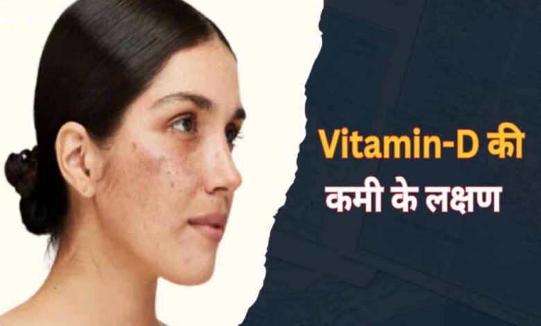 स्किन पर दिखते हैं विटामिन-D की कमी के 5 संकेत, हल्की समस्या समझकर न करें अनदेखा