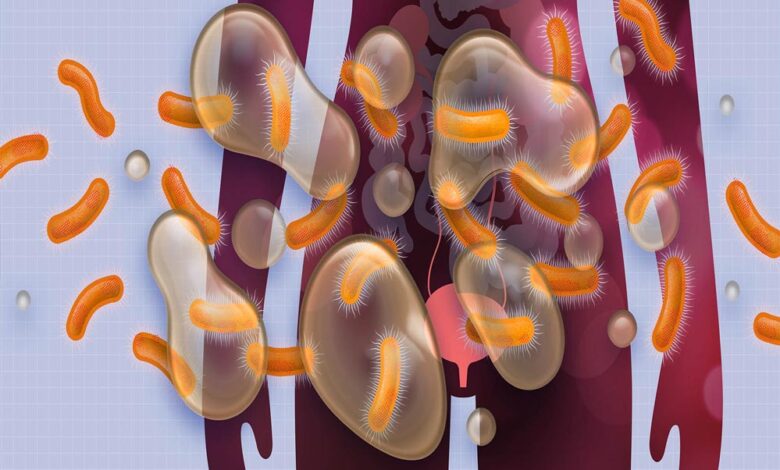 महिलाओं के लिए अहम जानकारी: पेशाब की नली के इंफेक्शन की 1 वजह, जलन से होता है बेहद परेशानी