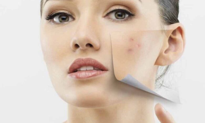 हरे-के-दाग-धब्बों-और-पिगमेंटेशन-को-करे-मात,-चावल-का-यह-घरेलू-नुस्खा-आजमाएं!