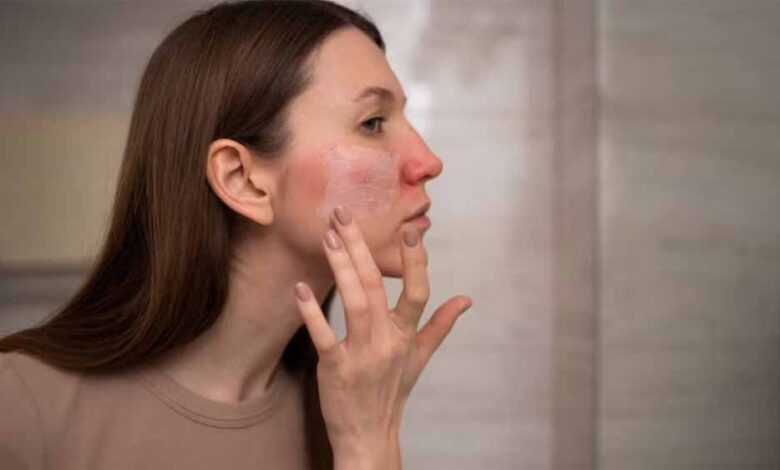 खूबसूरत-त्वचा-का-दुश्मन!-ये-3-फूड्स-अंदर-से-कर-रहे-हैं-स्किन-डैमेज,-तीसरा-सबसे-खतरनाक