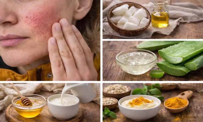 सर्दियों-में-रूखी-त्वचा-को-कहें-अलविदा:-दही-से-बने-5-फेस-पैक-जो-लौटाएं-नमी-और-निखार