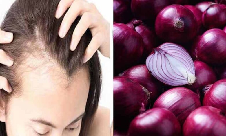 प्याज-का-तेल:-हेयर-फॉल-रोकने-का-घरेलू-नुस्खा