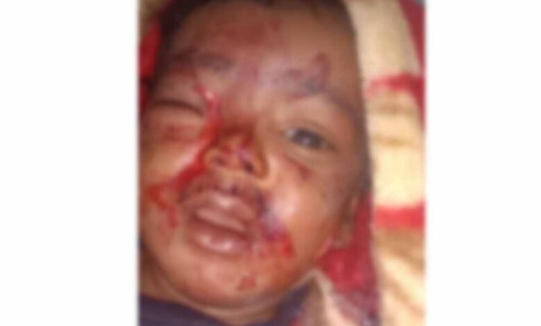 आंगन-में-खेल-रहे-6-माह-के-मासूम-को-आवारा-कुत्ते-ने-काटा,-जिला-अस्पताल-में-भर्ती